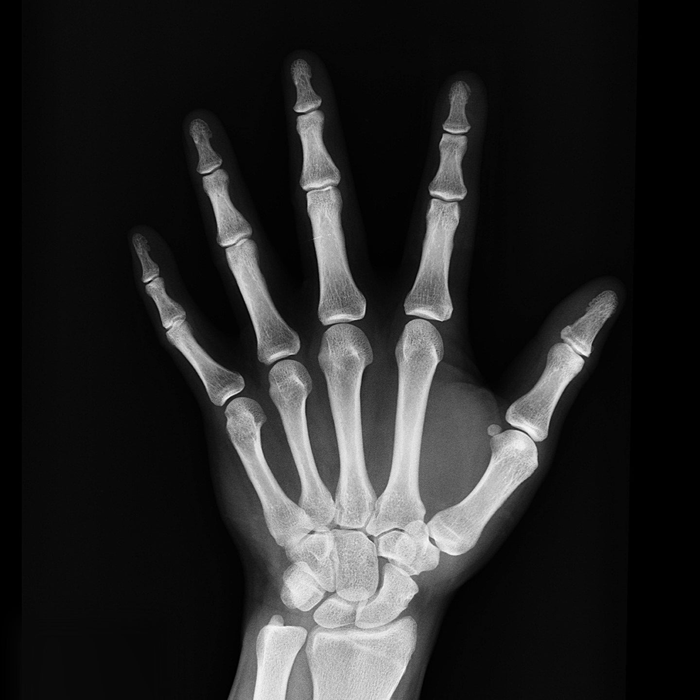 Hand