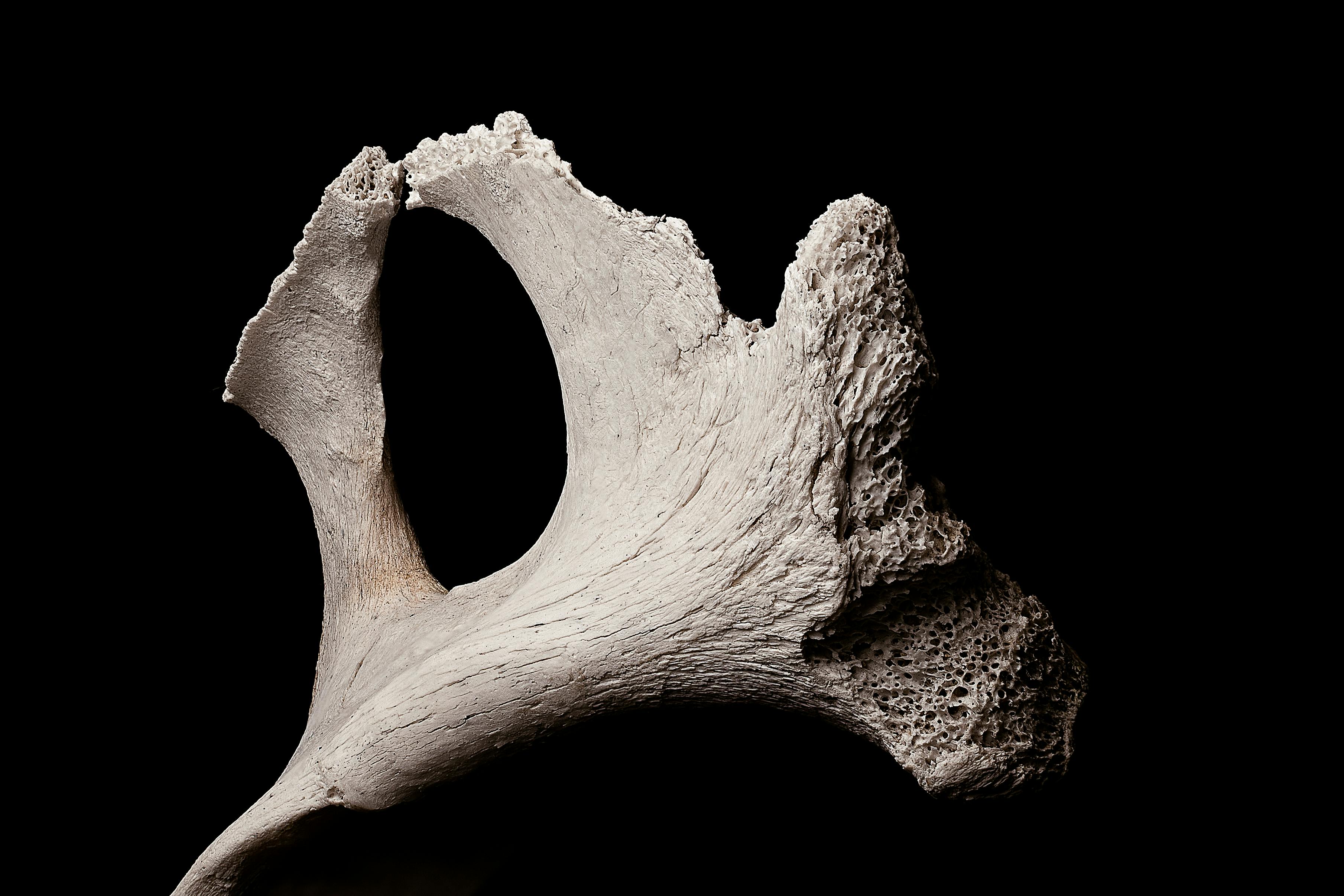 Close up view of a vertebra on a black background.