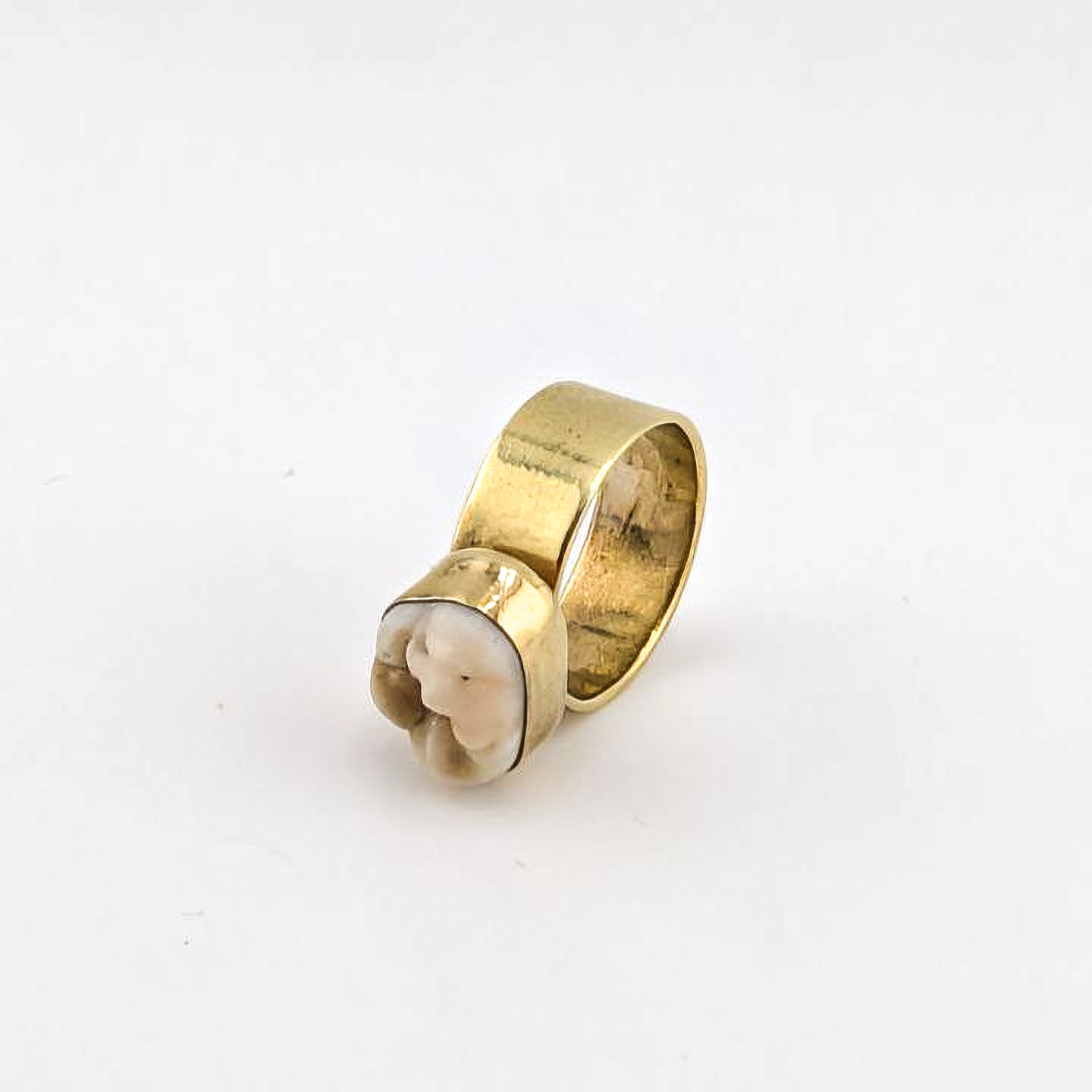 Personal Bite Ring