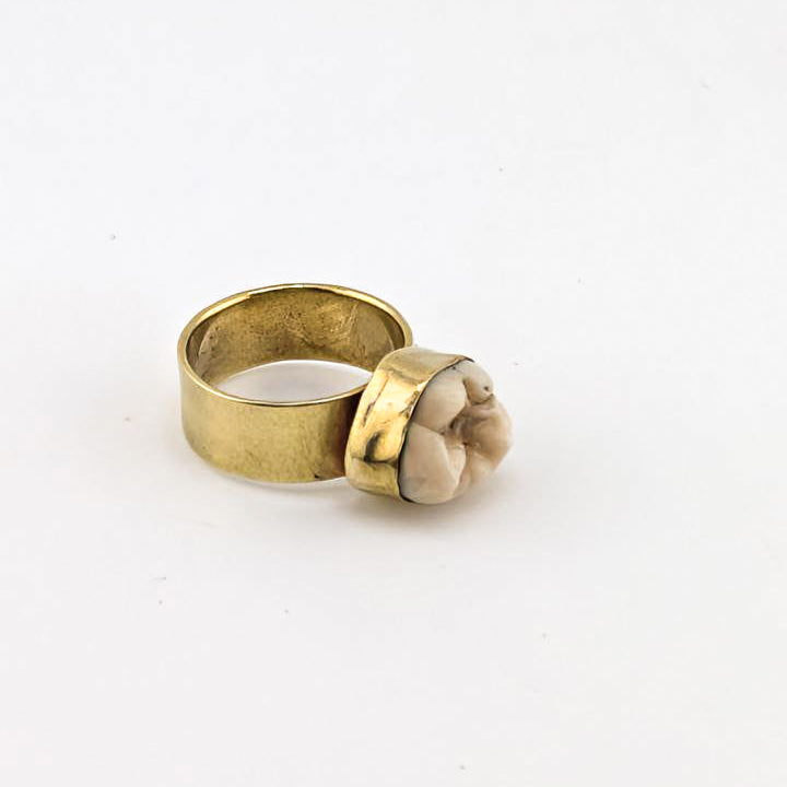 Personal Bite Ring