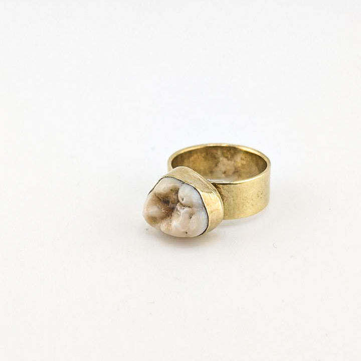 Personal Bite Ring